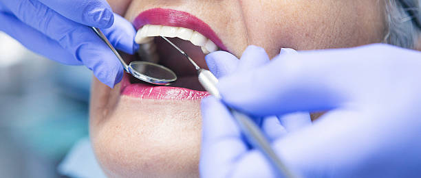 Best Emergency Tooth Extraction in Lake Tapps, WA